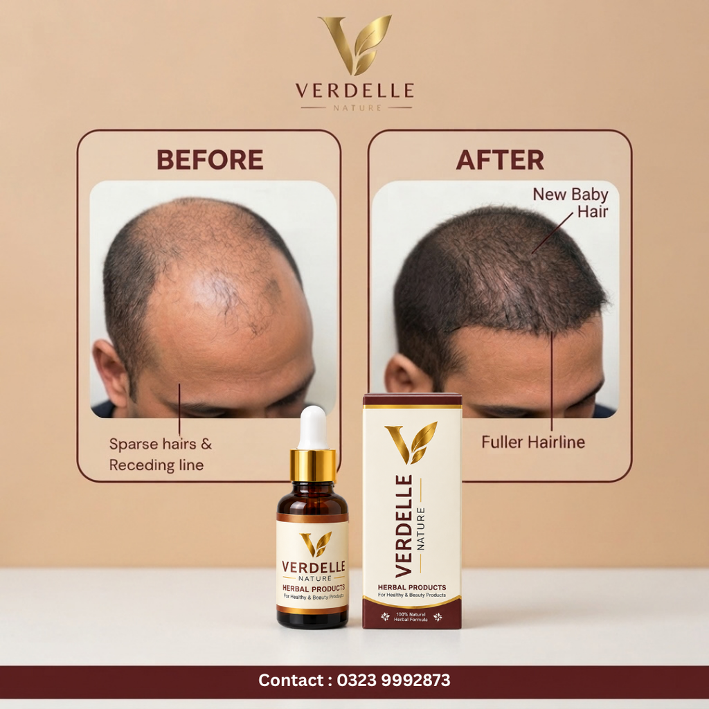 Verdelle Nature Herbal Hair Serum | Advanced Hair Growth & Root Nourishment Formula For New Hairs